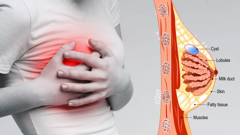 breast pain