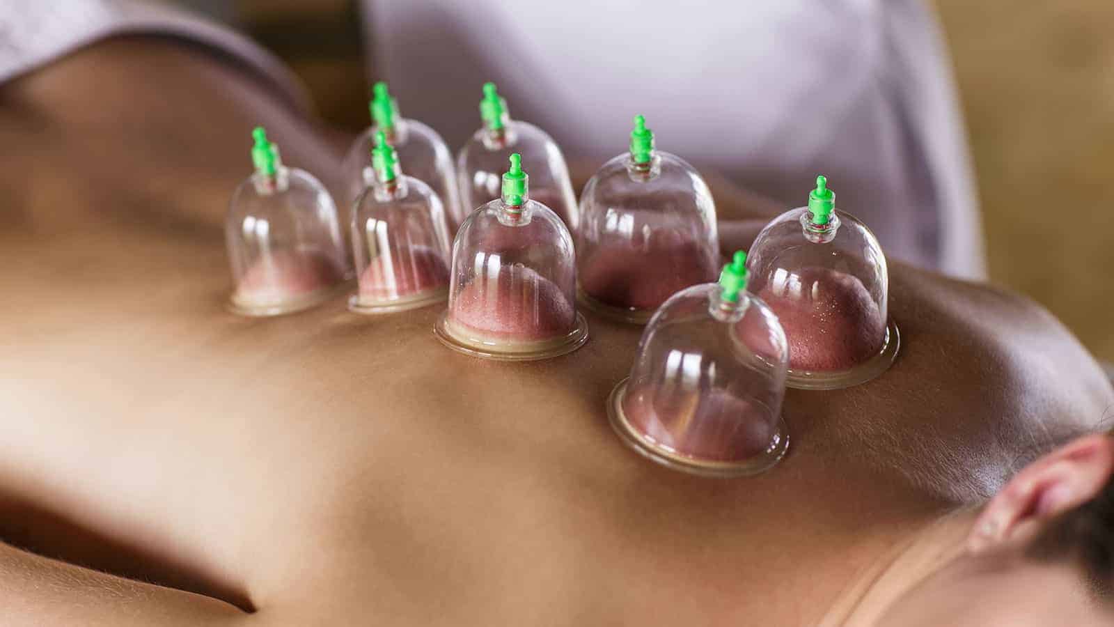 Here’s How Cupping Therapy Can Reduce Muscle Tension And Improve Blood Flow