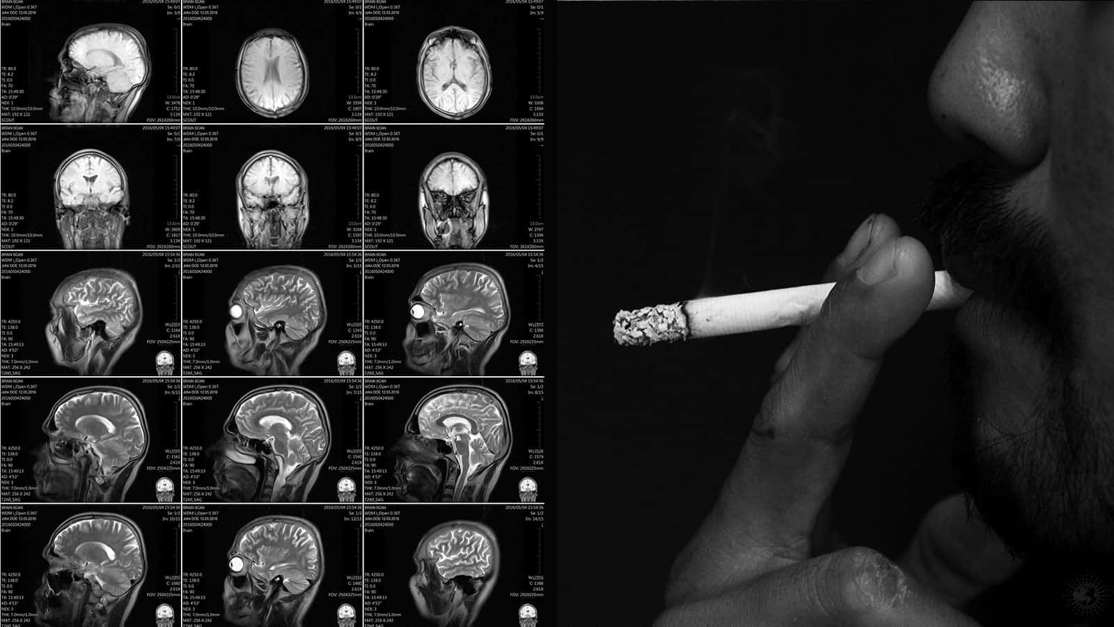 Here’s How Nicotine Impacts The Brain