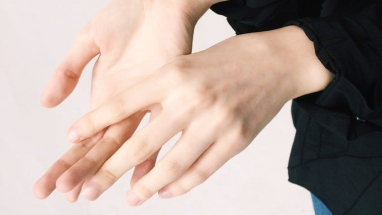psoriatic arthritis