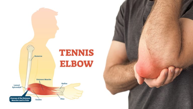 tennis elbow symptoms