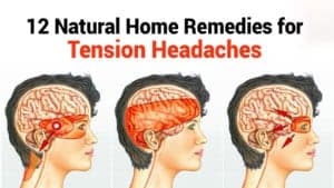 tension headache remedies