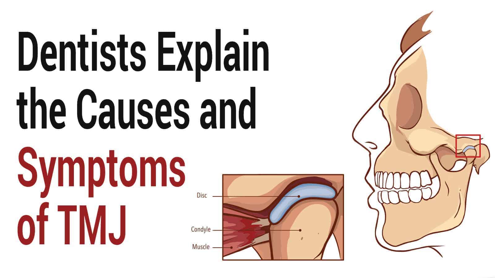 Dentists Explain the Causes and Symptoms of TMJ