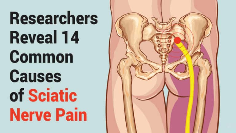 sciatic nerve pain