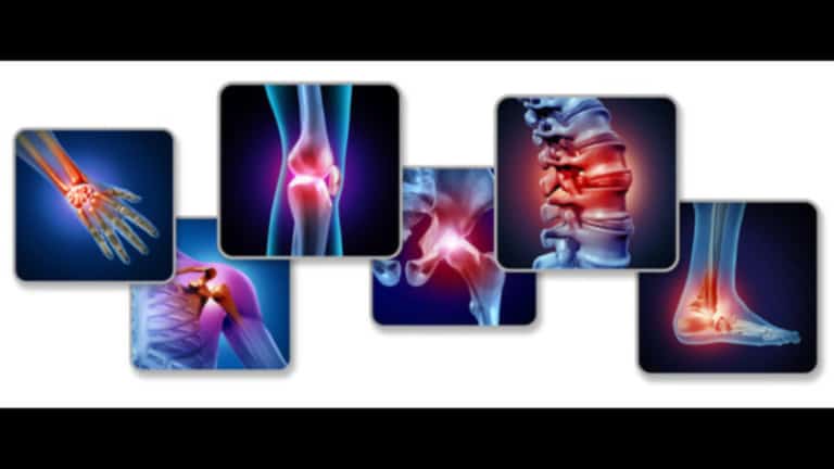 glucosamine
