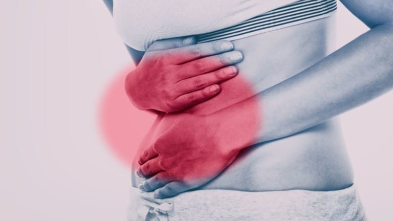 ulcerative colitis