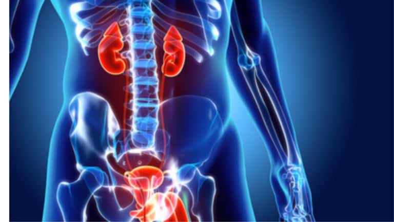cloudy urine causes