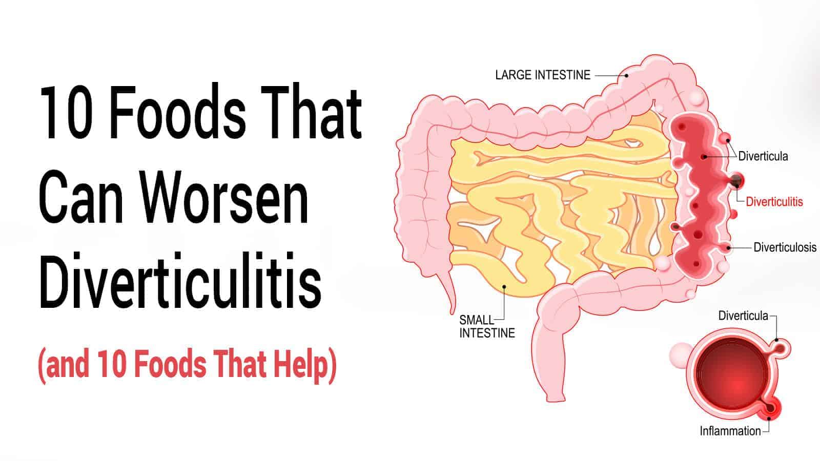 10 Foods That Can Worsen Diverticulitis (and 10 Foods That Help)