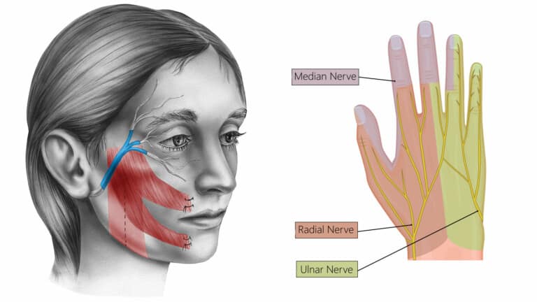 nerve damage