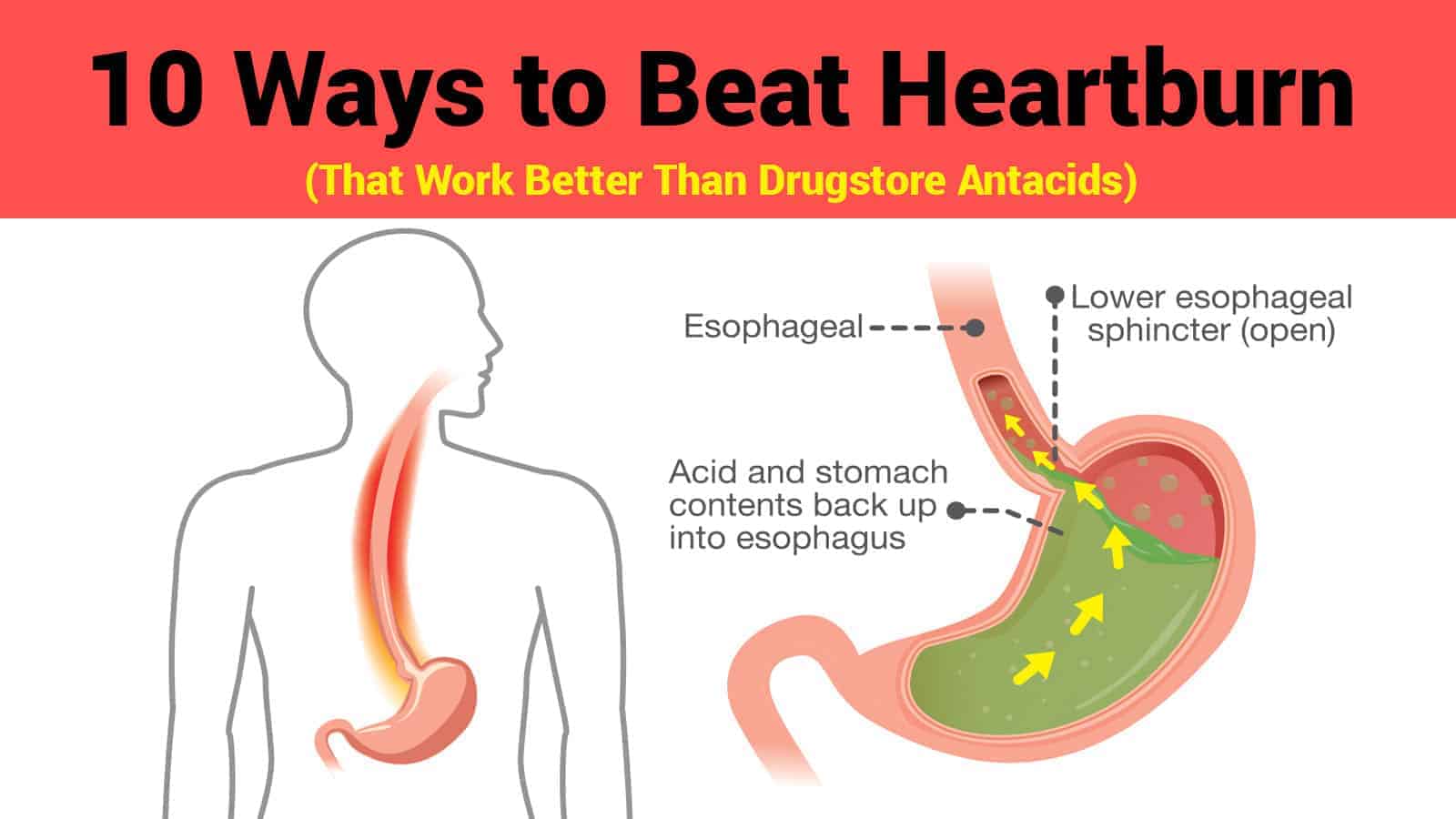 10 Ways to Beat Heartburn (That Work Better Than Drugstore Antacids)
