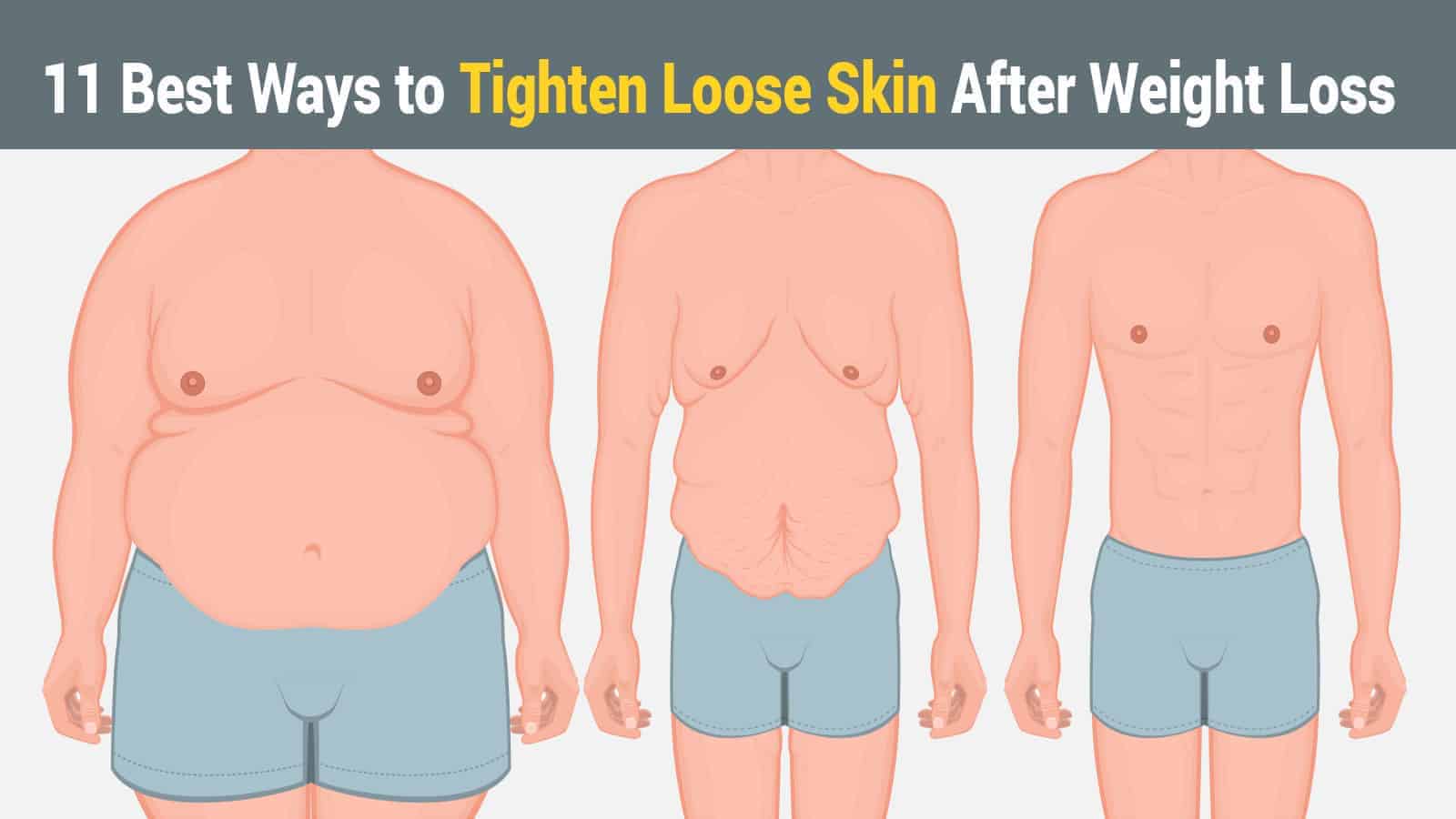 11 Best Ways to Tighten Loose Skin After Weight Loss