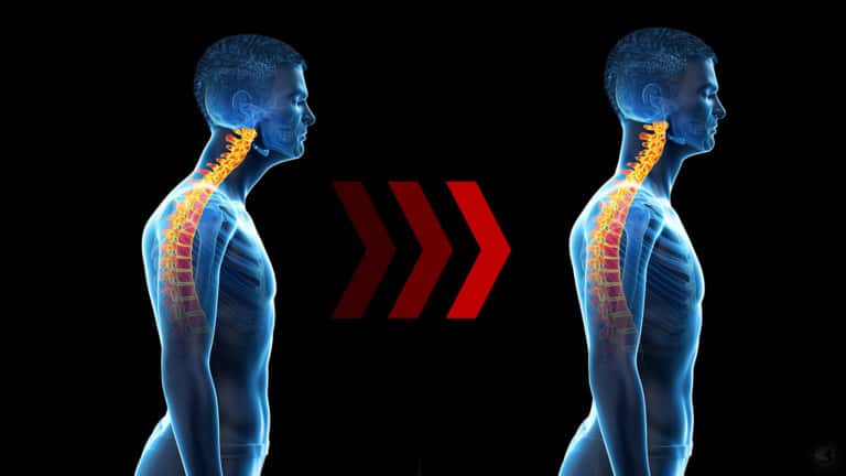text neck
