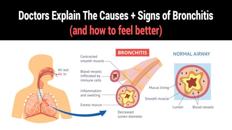 bronchitis