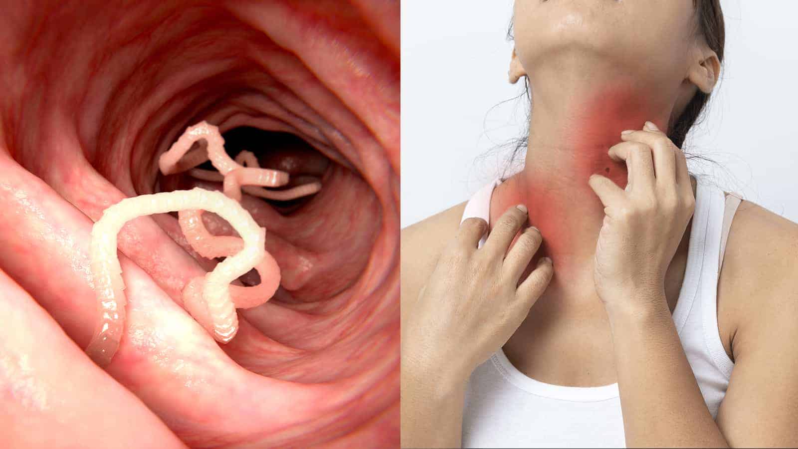 15 Signs of a Parasitic Infection Never to Ignore