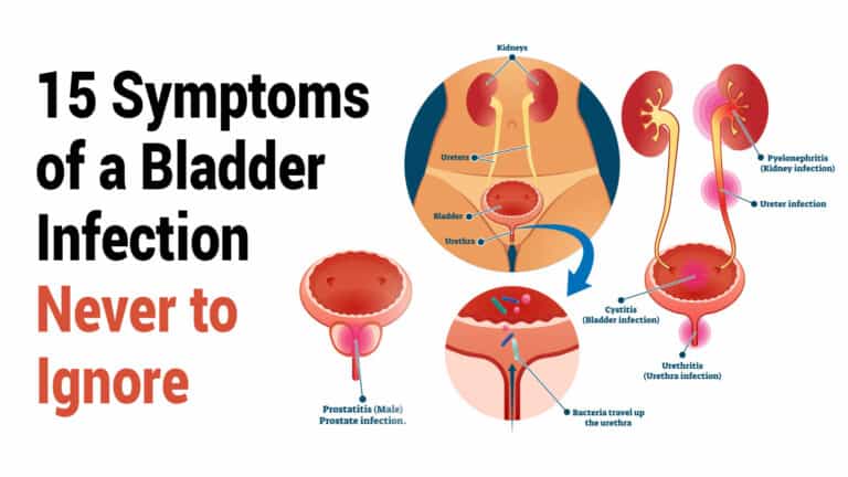 bladder infection