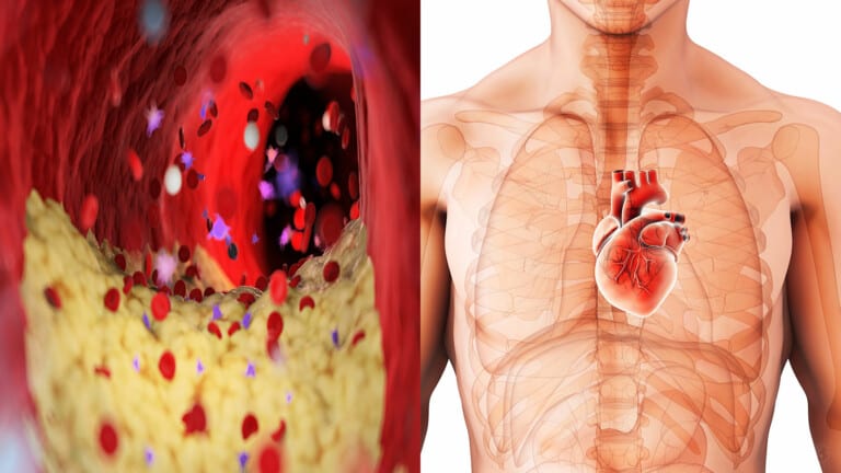 heart health