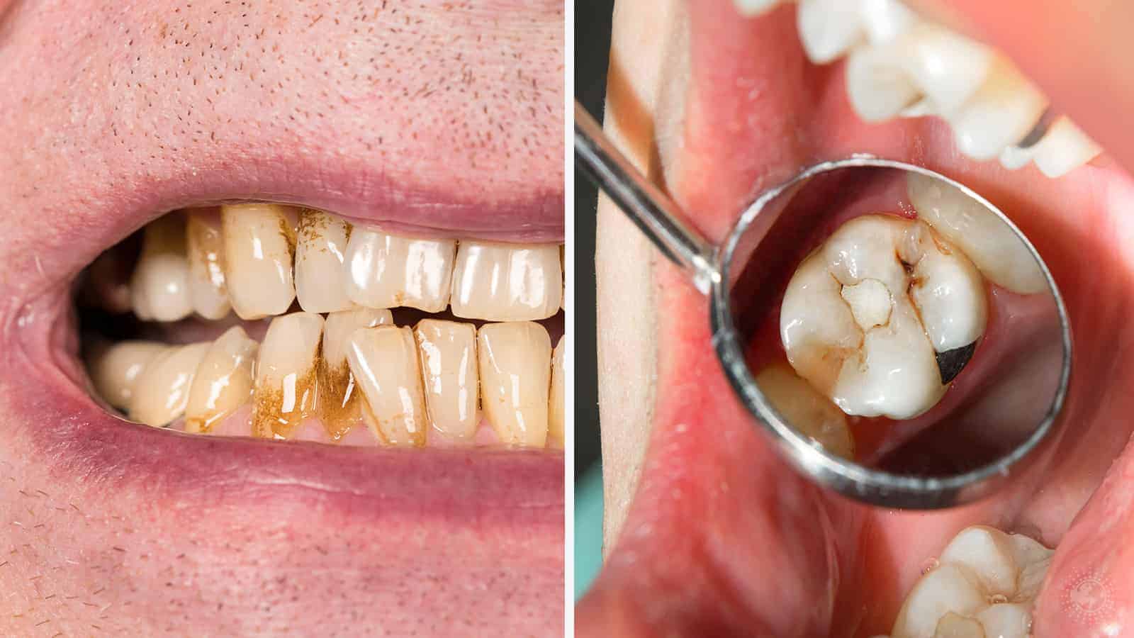 Dentists Explain 10 Things Your Mouth Reveals About Your Health