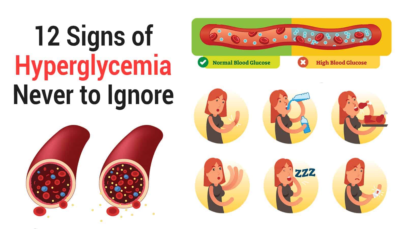 12 Signs of Hyperglycemia Never to Ignore