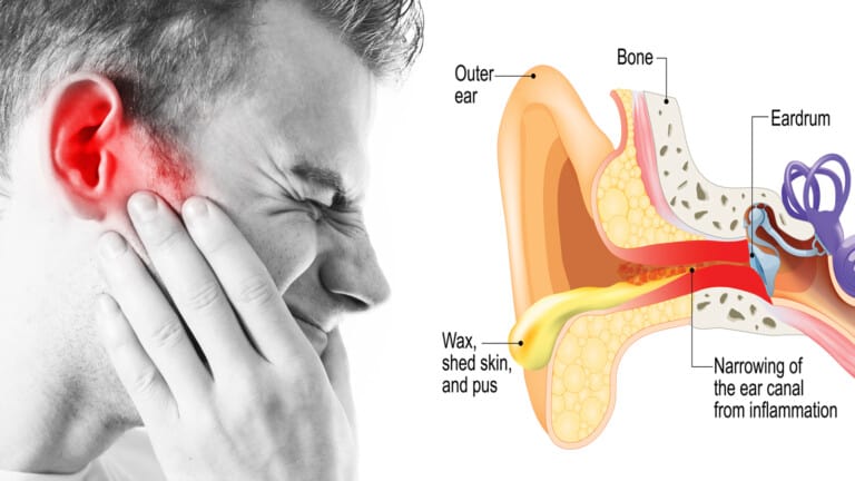 swimmers ear