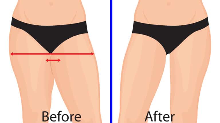 thigh fat