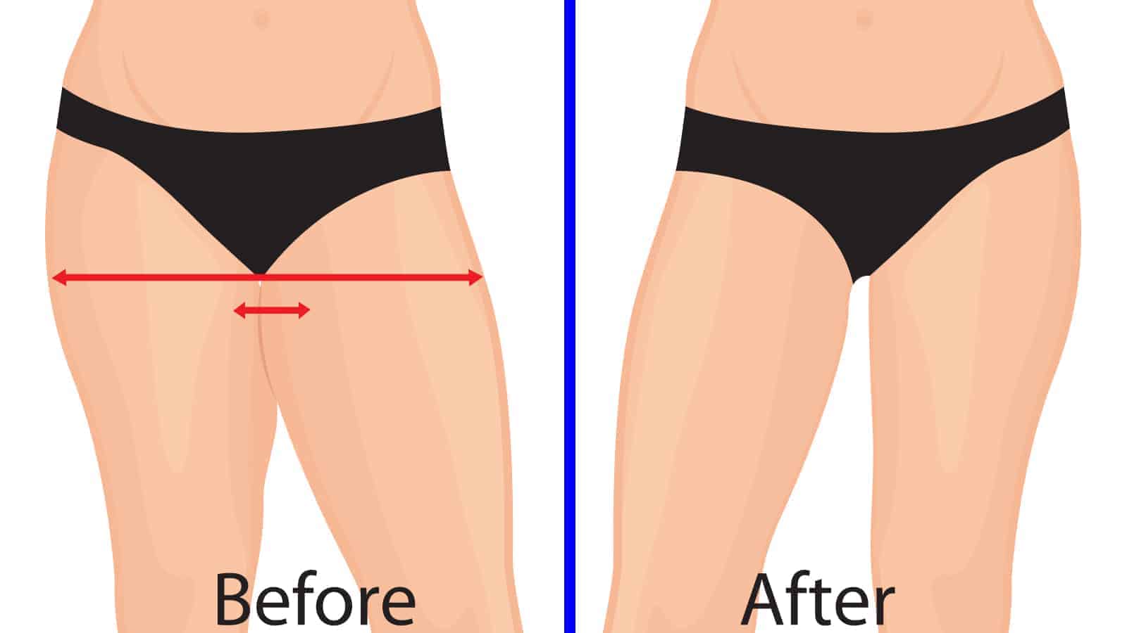 4 Effective Ways To Get Rid Of Thigh Fat And Tone Your Legs