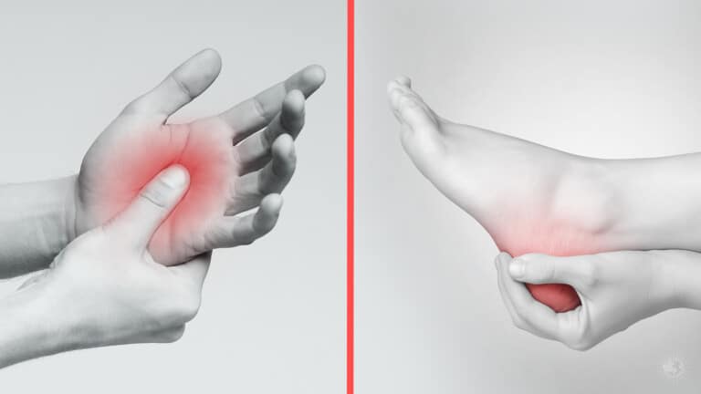 neuropathy