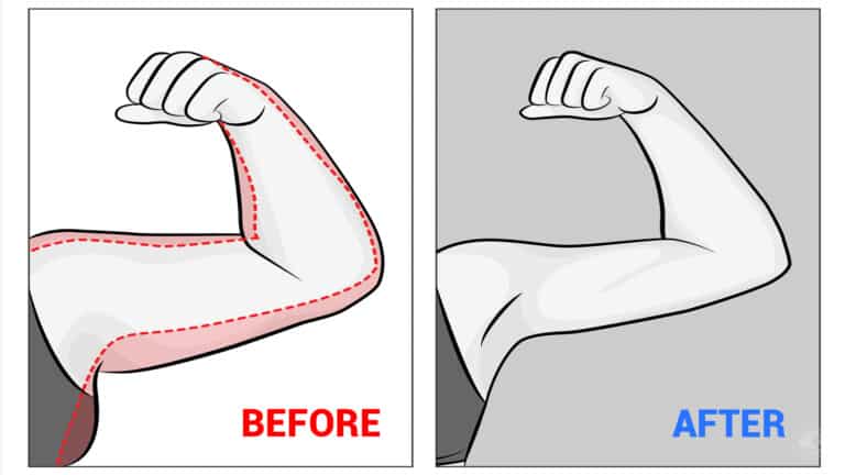arm exercises