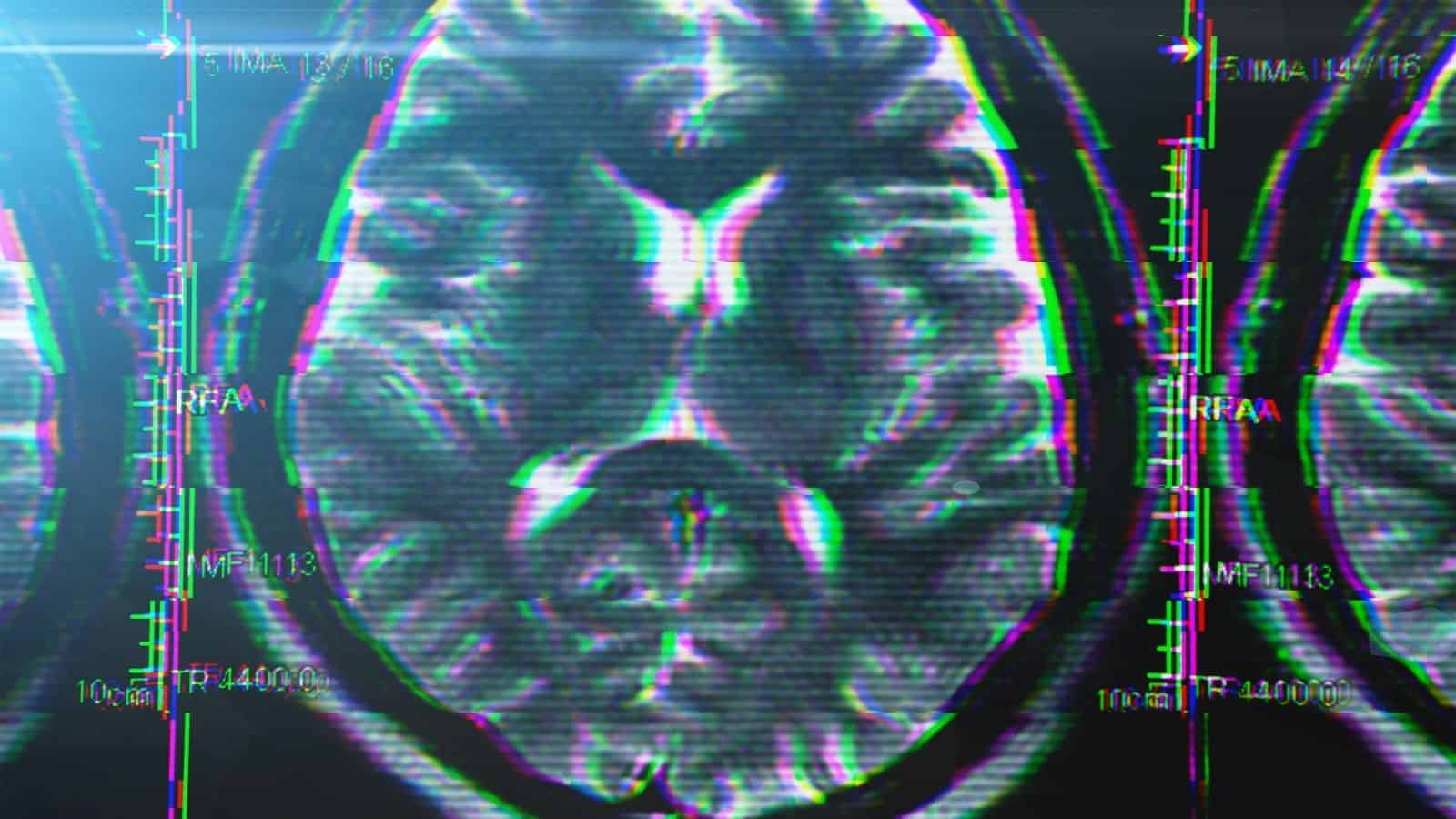 10 Brain Hacks That Help Improve Your Memory