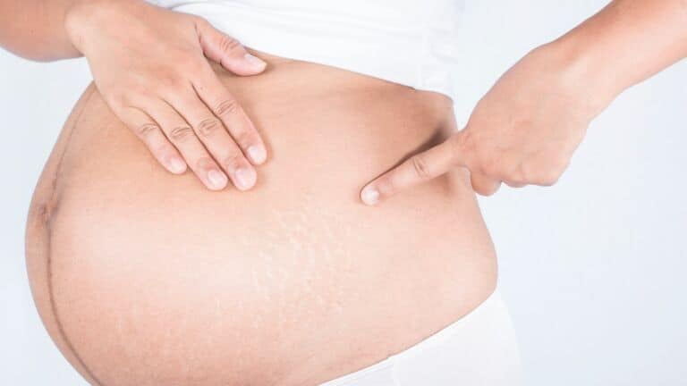 prenatal depression