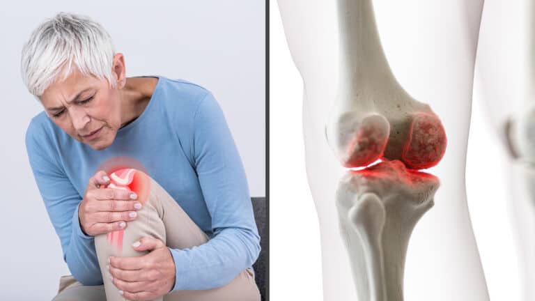 arthritis pain