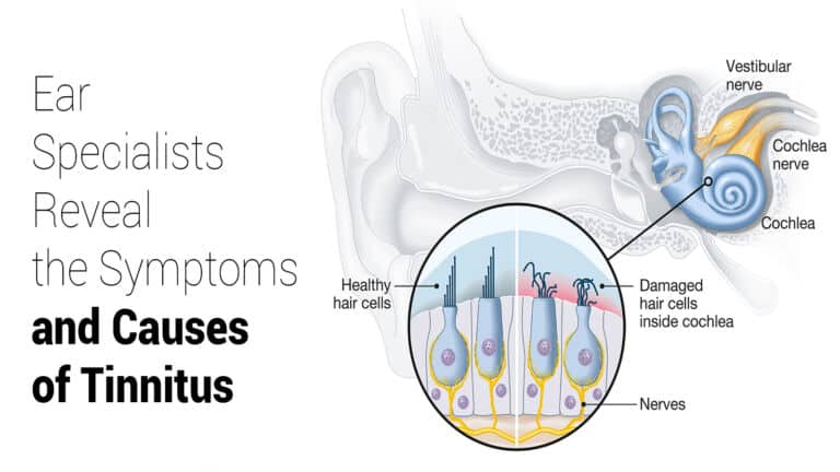 tinnitus