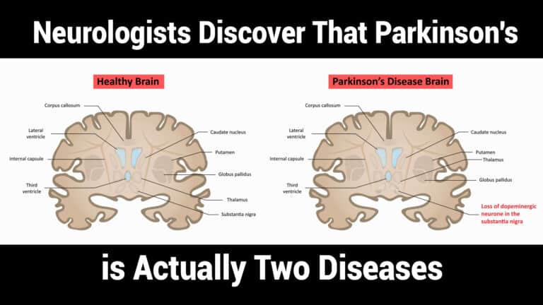 parkinsons