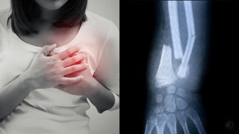 calcium deficiency