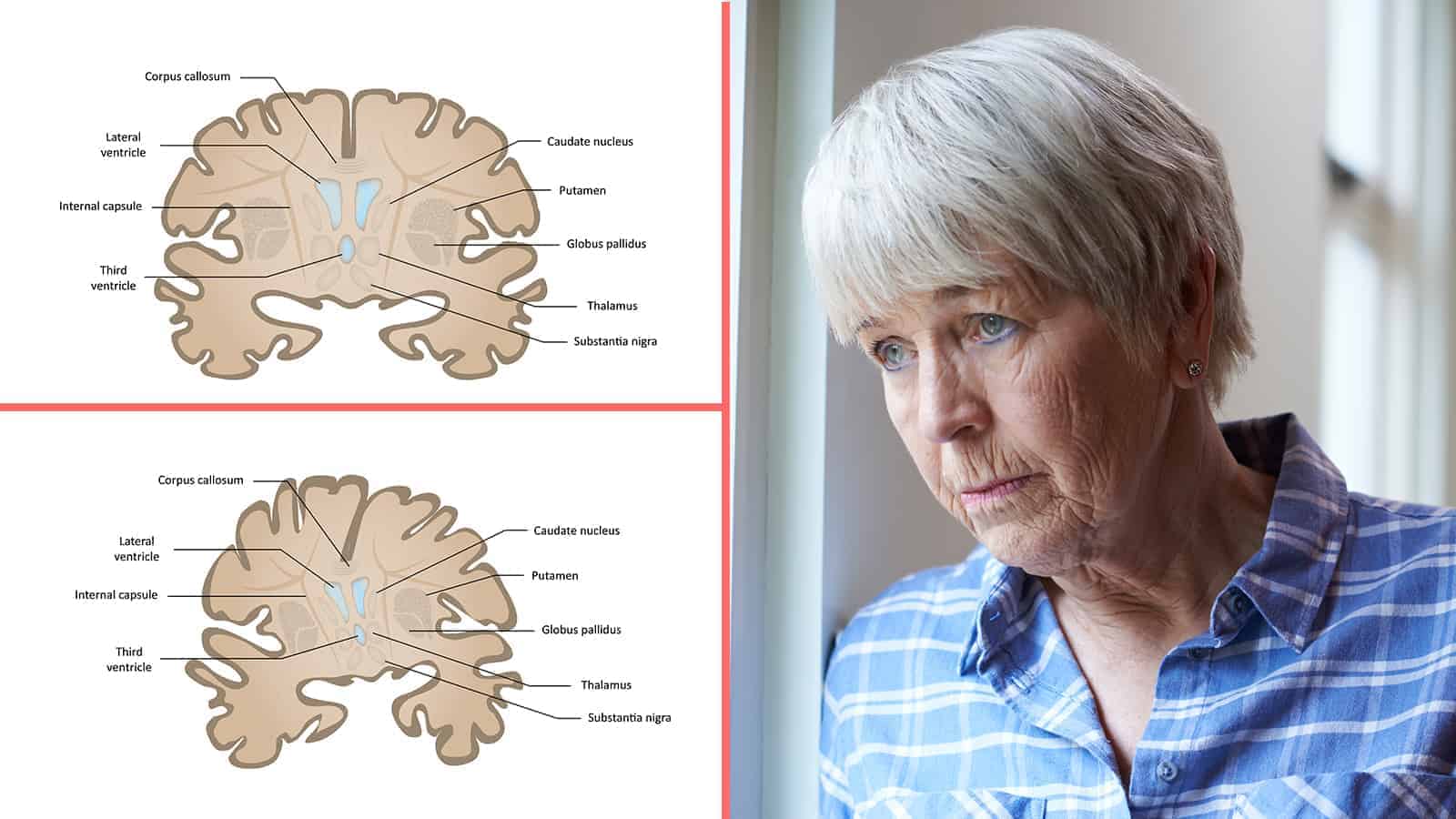 Science Reveals 8 Habits That Reduce Dementia Risk