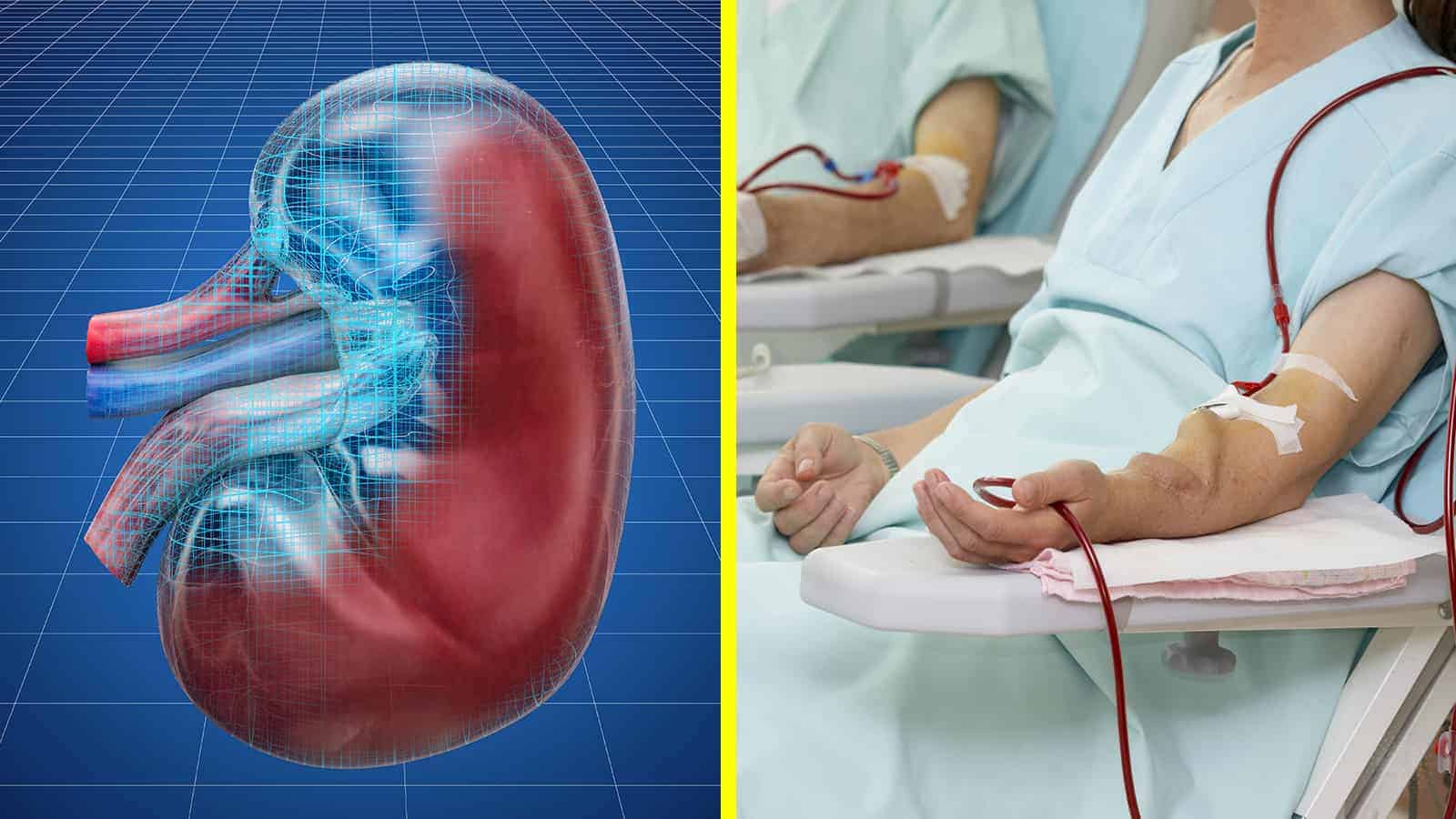 Scientists Explain How an Artificial Kidney Could Replace Dialysis