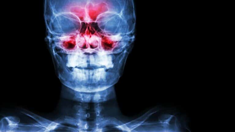 sinus pain