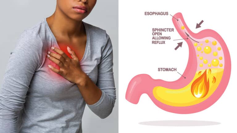 avoid heartburn