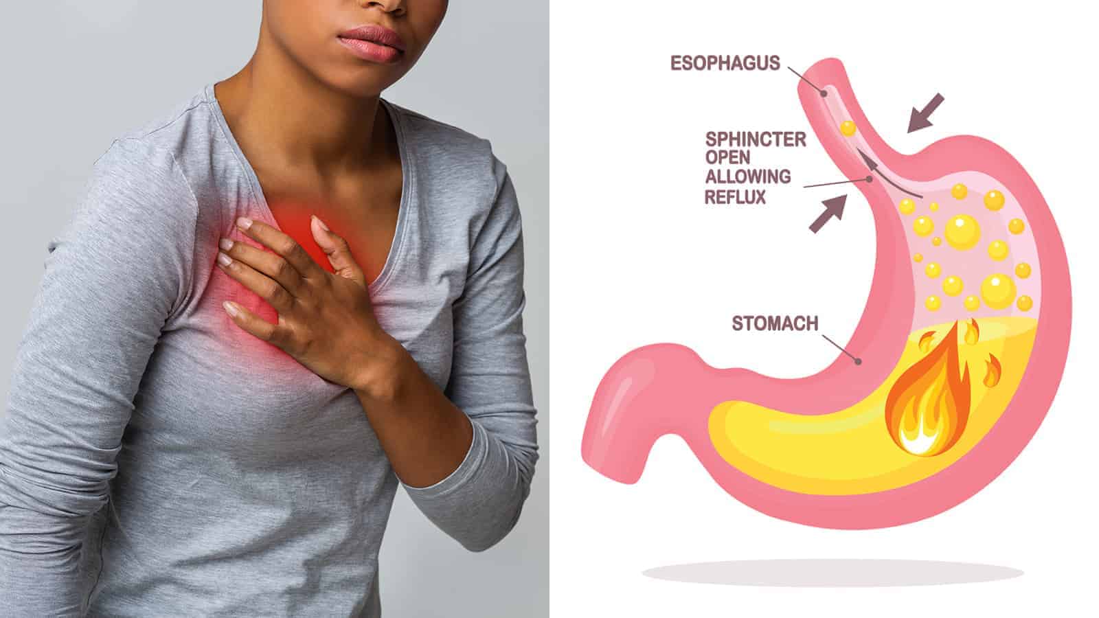 Doctors Reveal 4 Ways To Avoid Heartburn (And 5 Ways to Fix It)