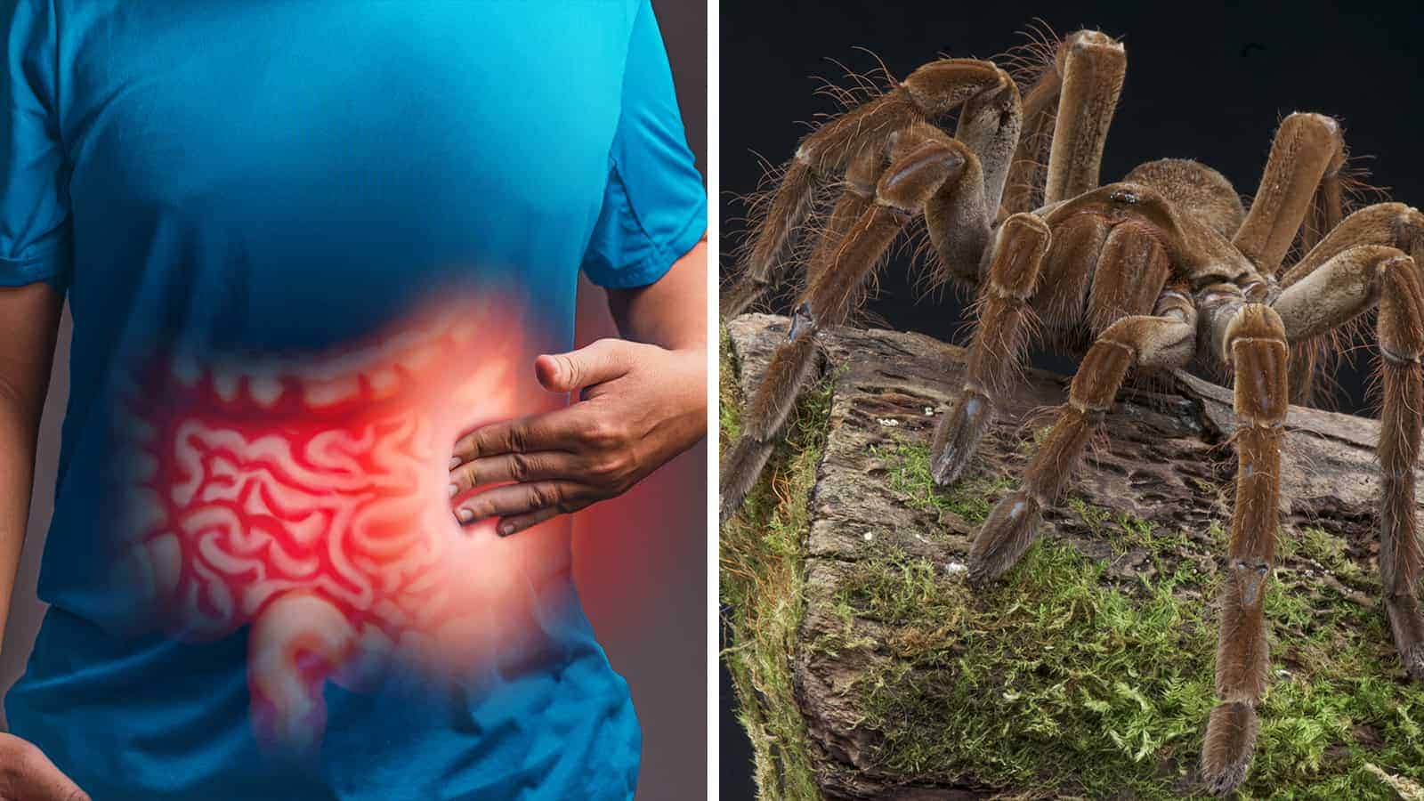 Research Reveals a Spider Venom That May Help IBS