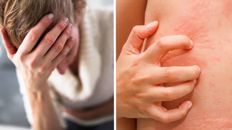 too much essential oil