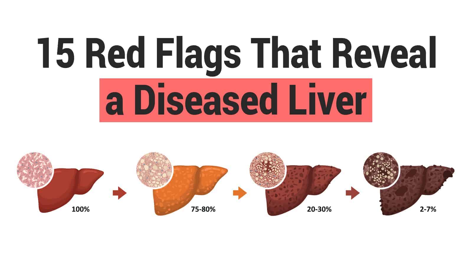 15 Red Flags That Reveal a Diseased Liver