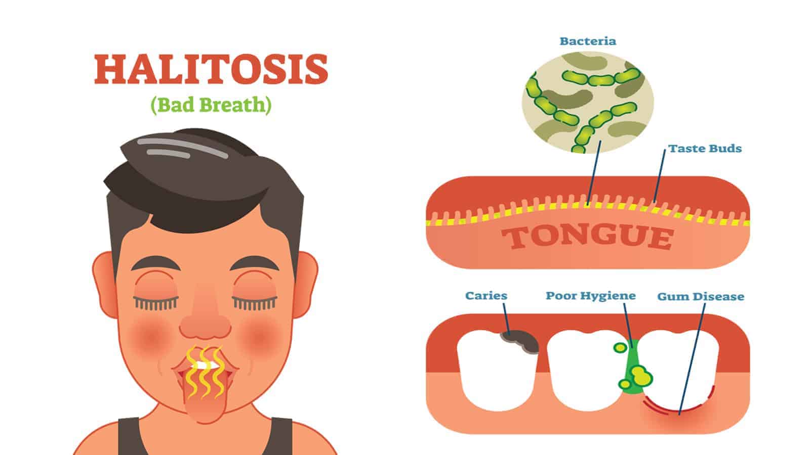 Dentists Explain 10 Causes of Halitosis (And How to Fix It)