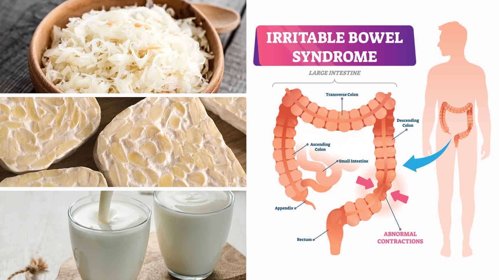 Dietitians Reveal a Life Changing IBS Eating Plan