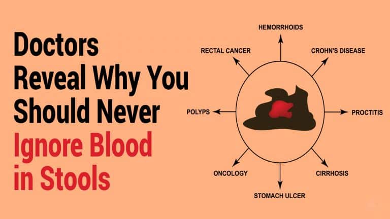 blood in stools