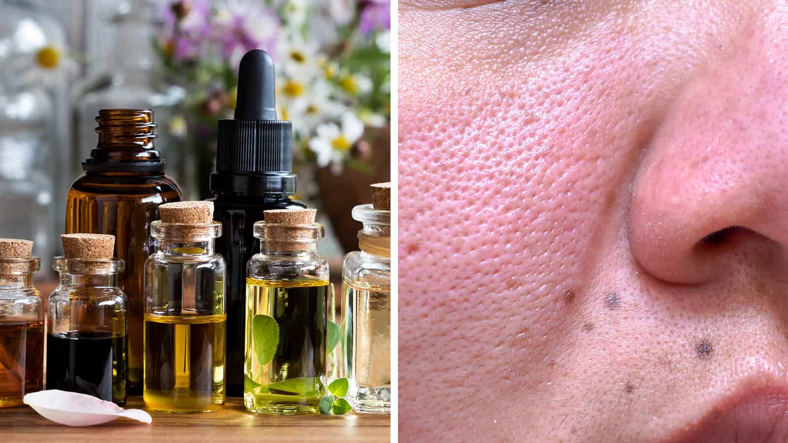 10 Essential Oils That Can Help Oily Skin