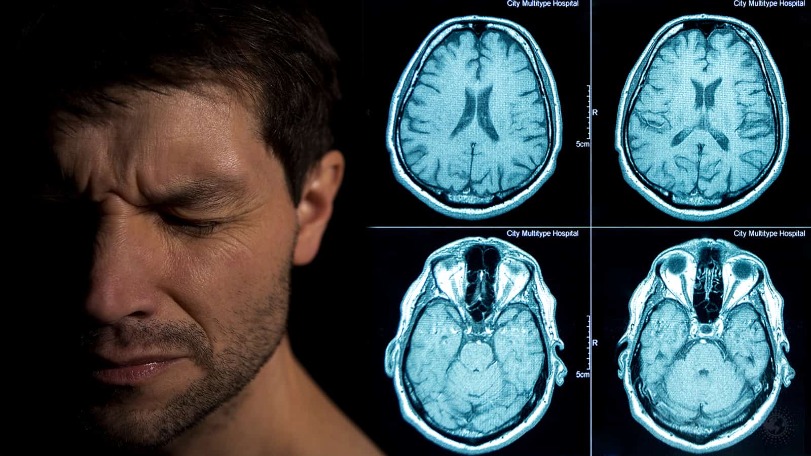 New Brain Imaging Technology Helps Reveal PTSD