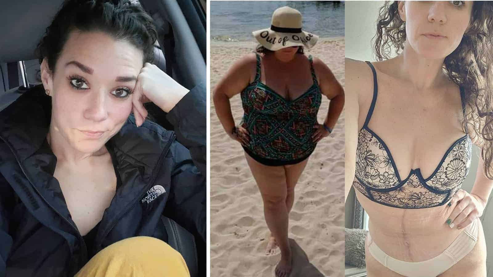 Woman Loses Weight (165 lbs) and Shares Her Amazing Story