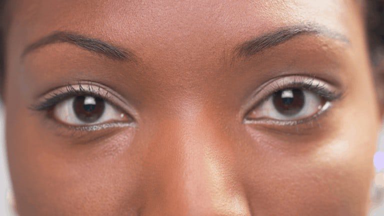 healthy eyes