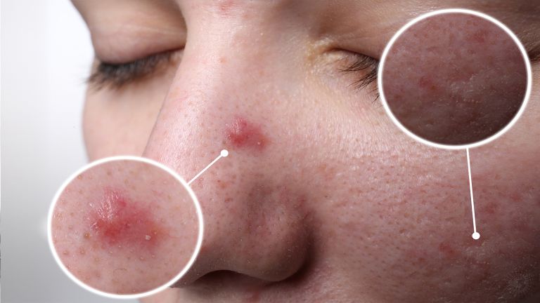 skincare tips