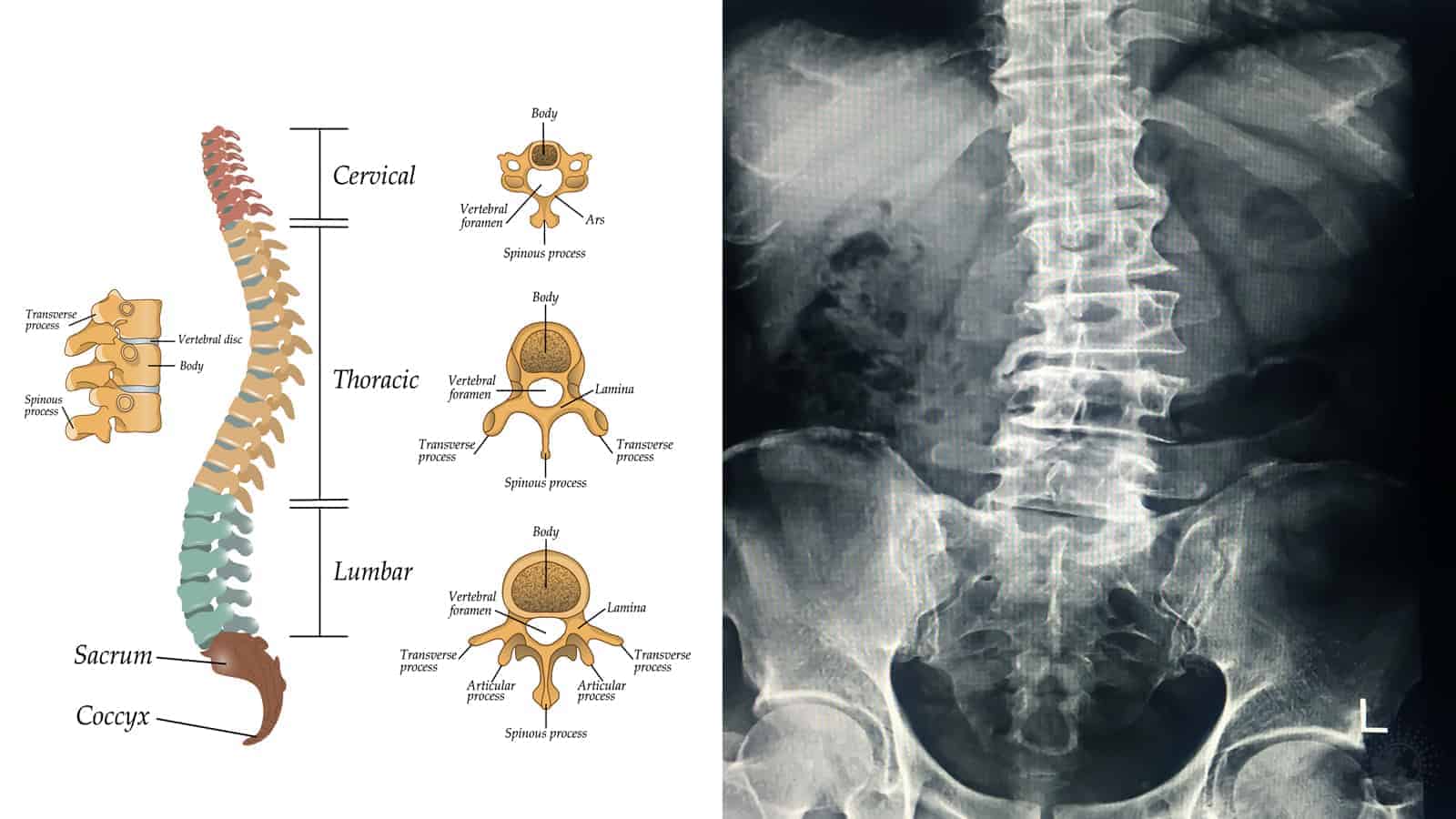 15 Habits That Improve Spinal Alignment and Reduce Back Pain